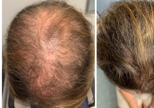 What is the best time of day to scalp?